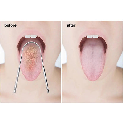 Nettoyage de langue en acier inoxydable